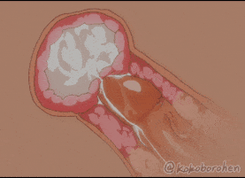 新作-Nami - Kokoboro